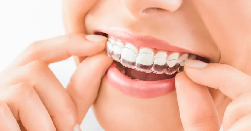 Klinika Invisalign Warszawa